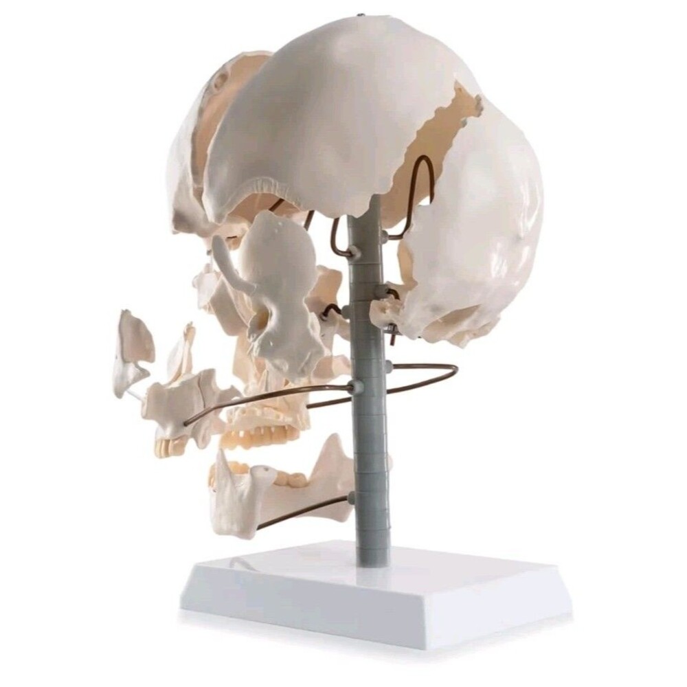 22-Piece Exploded Human Skull Model, Full Size, Bone Color Disassembled Cranial - Picture 4 of 12